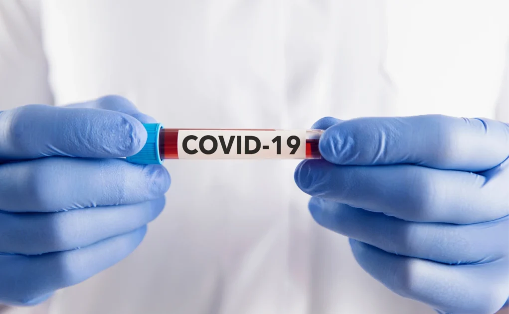 COVID-19
