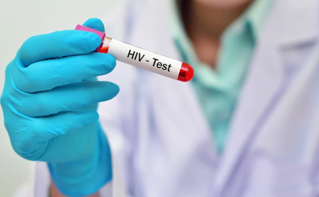 HIV/AIDS