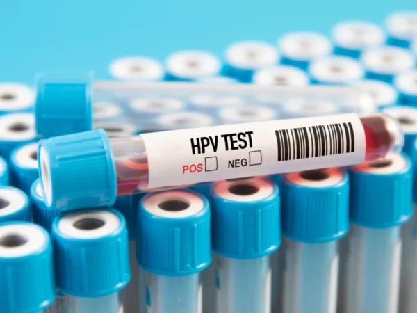 HPV infection